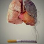 Merokok dan Risiko Penyakit Jantung yang Mematikan