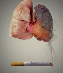 Merokok dan Risiko Penyakit Jantung yang Mematikan